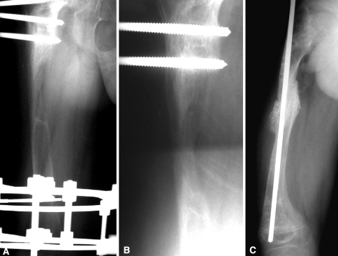 Fig. 2A–C