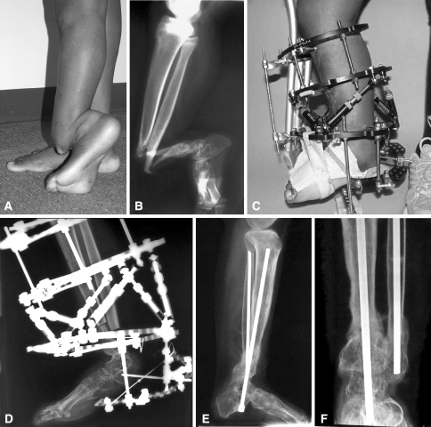 Fig. 1A–F