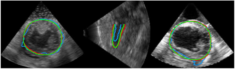 Figure 11