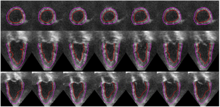 Figure 14