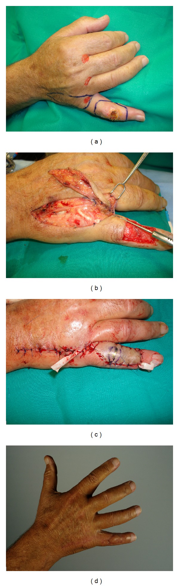 Figure 2