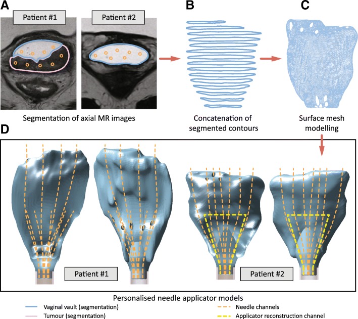 Fig. 2