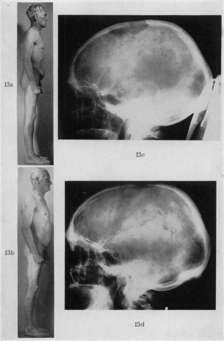 Fig. 13