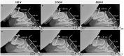 Fig 10
