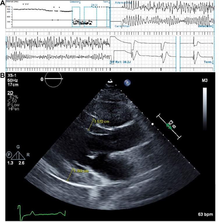 Figure 2