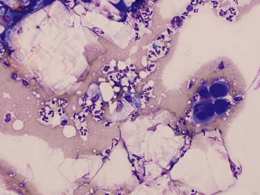 Fig. 15.41