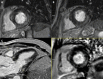 Fig. 20