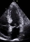 Fig. 18