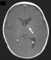 Fig. 39