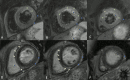 Fig. 24