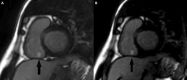 Fig. 15