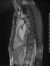 Fig. 16