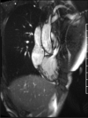 Fig. 17