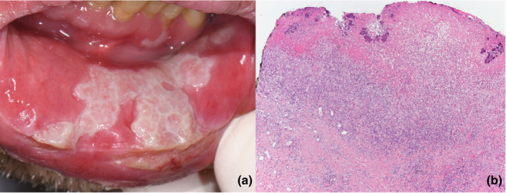 FIGURE 1