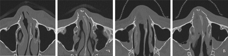 Fig. 5