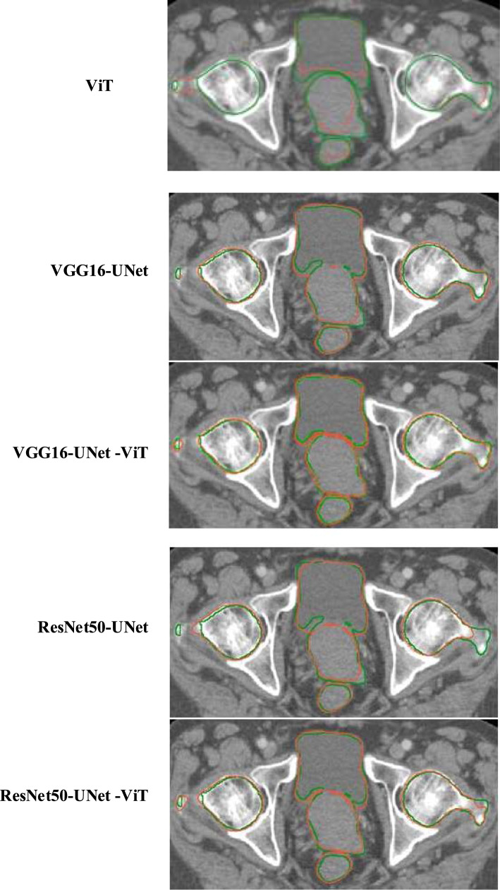 Fig. 4