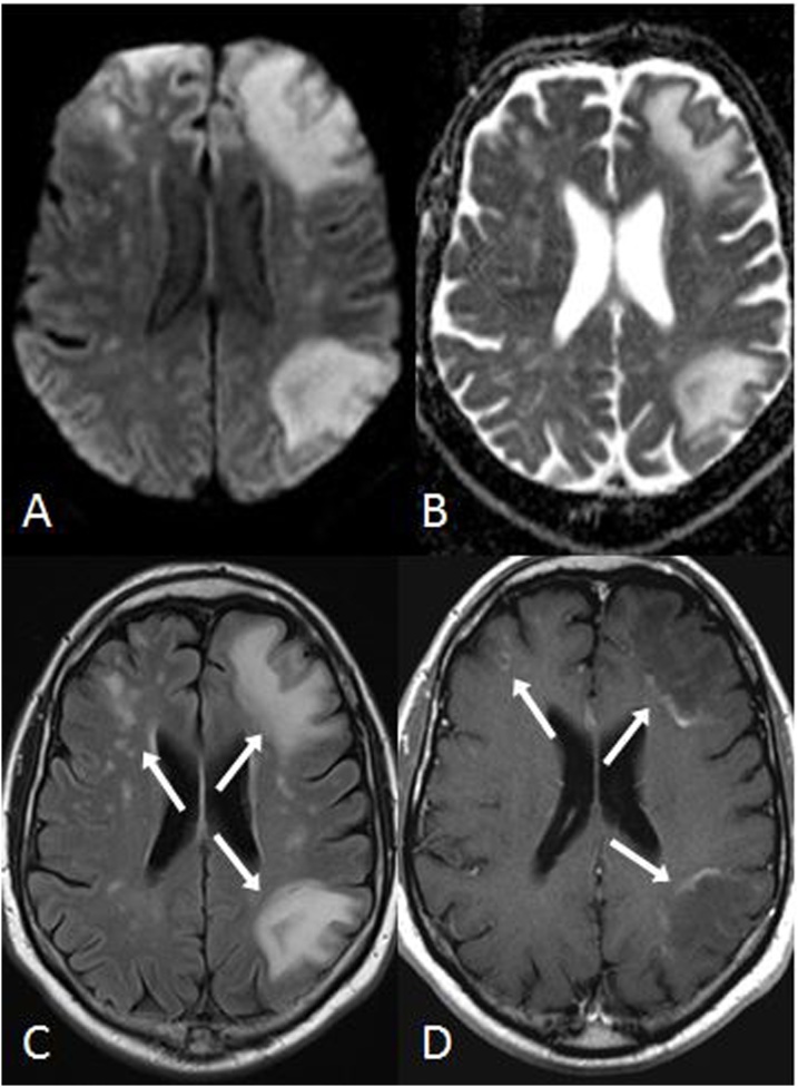 Fig. 15