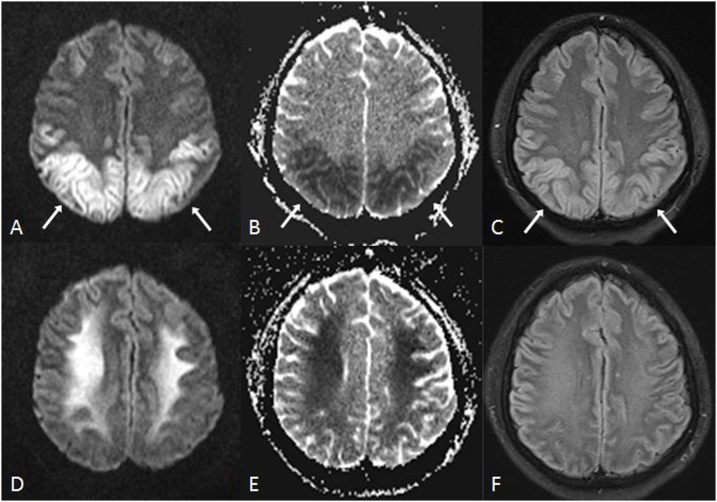 Fig. 13