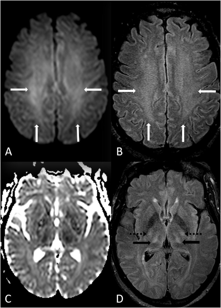 Fig. 12