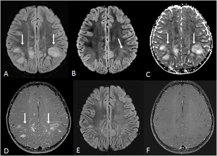 Fig. 14