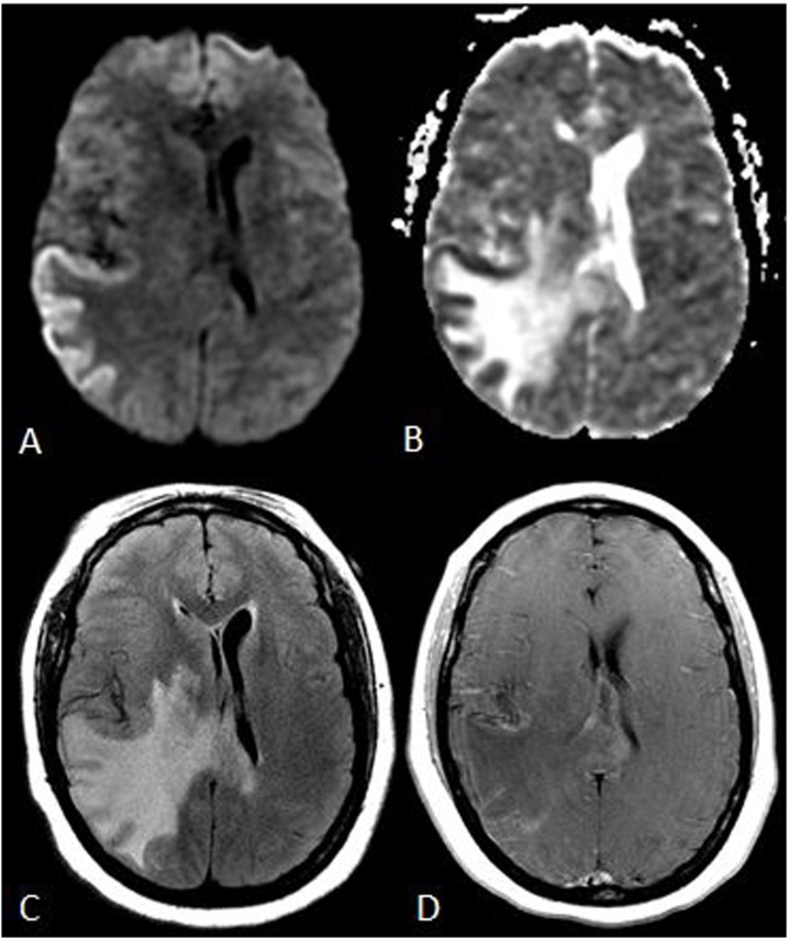 Fig. 16