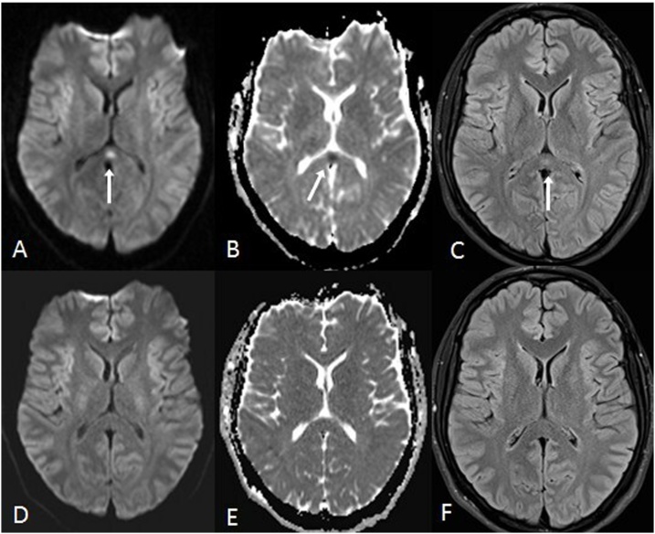 Fig. 10