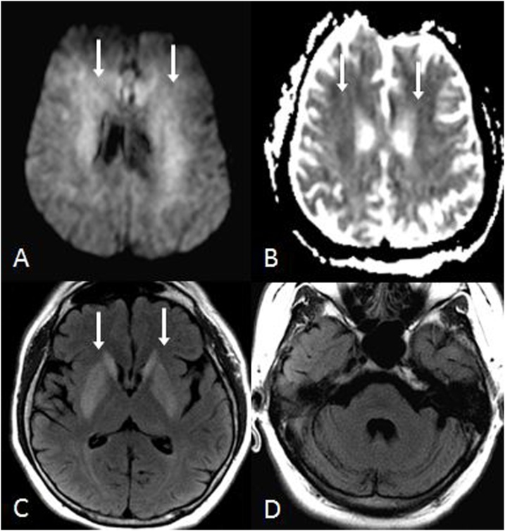 Fig. 11