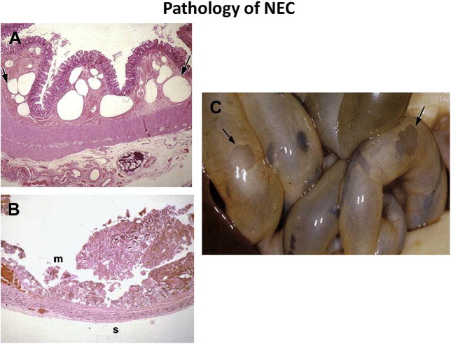 Fig. 12