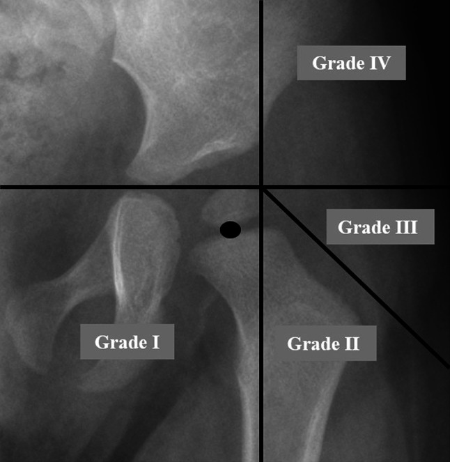 Fig. 4