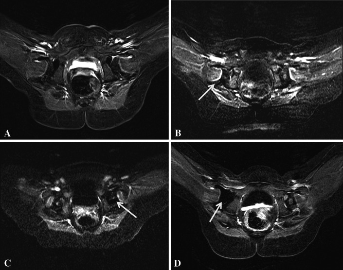 Fig. 2A–D