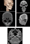Figure 4