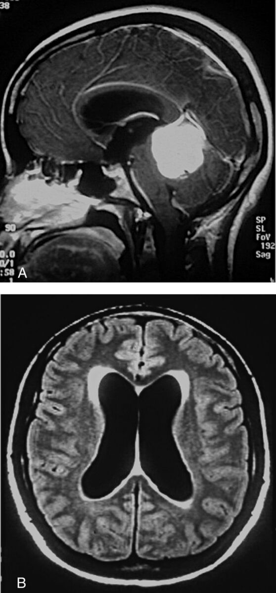 Fig 3.