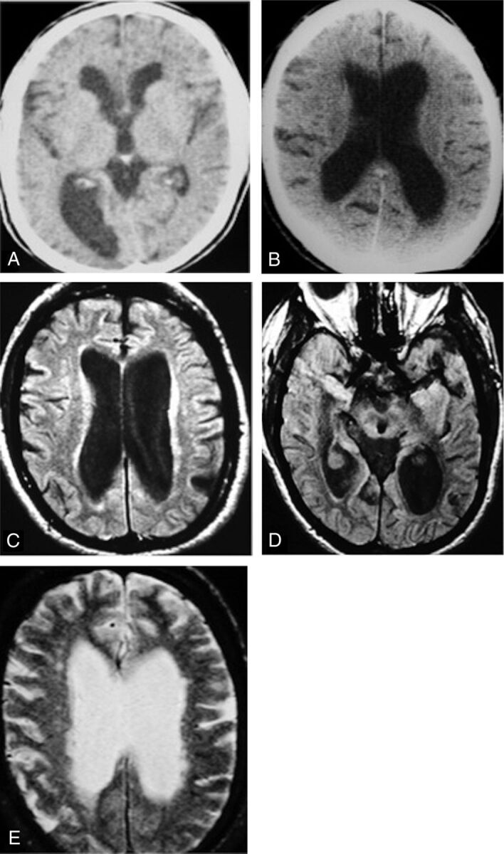 Fig 10.