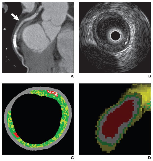 Fig. 4