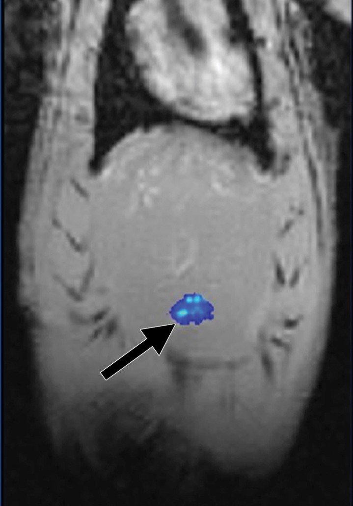 Figure 3c: