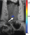 Figure 3d: