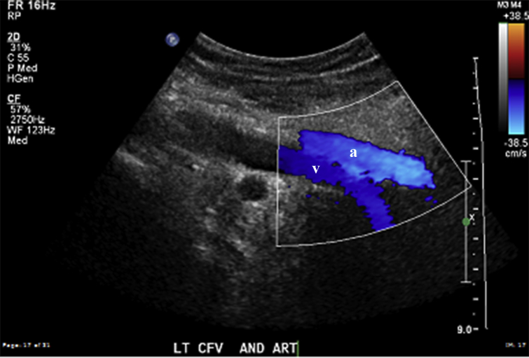 Fig 2