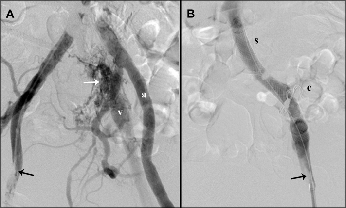 Fig 3