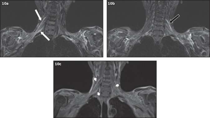 Fig. 10