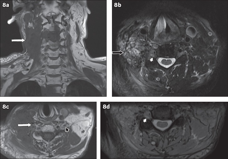 Fig. 8