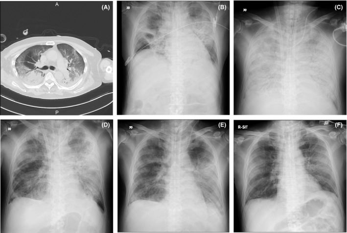 Fig. 2