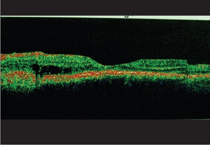 Figure 3c