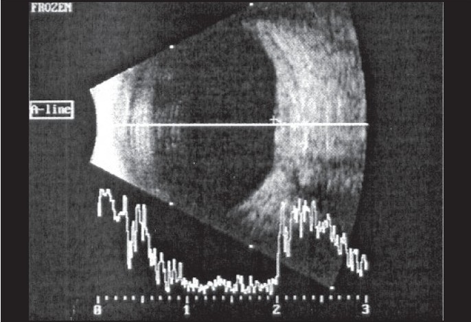 Figure 3b