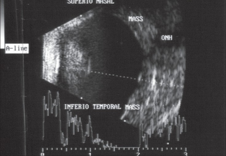 Figure 2B