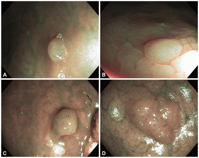 Fig. 2