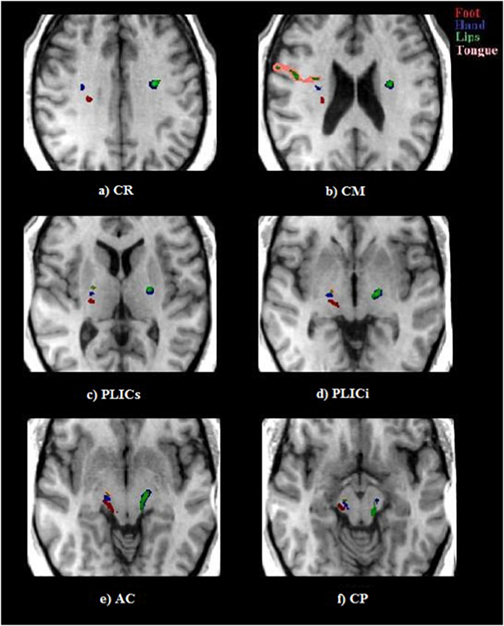 Fig. 3