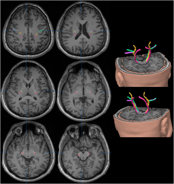 Fig. 4