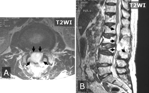 Fig. 3A–B