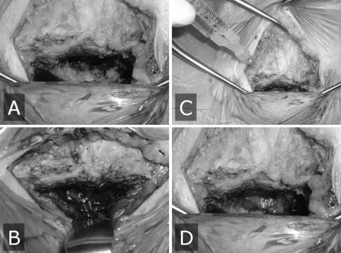 Fig. 1A–D