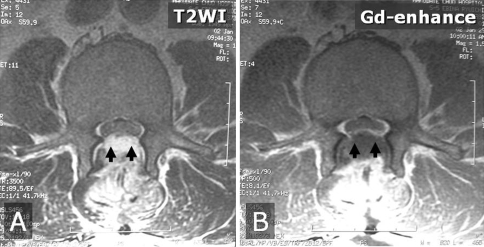 Fig. 2A–B